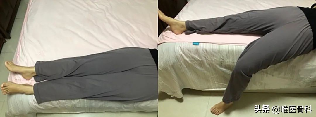 腰椎术后病人怎么调理,腰椎疾病术后家庭康复指南