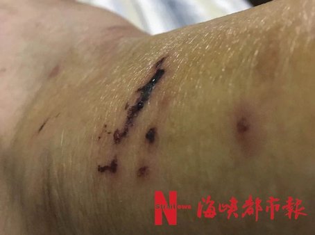 有恶犬的视频,有恶犬可以报警吗