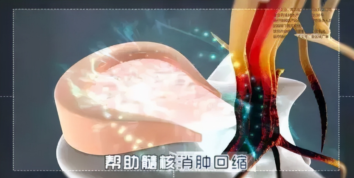 治腰椎间盘突出的铁腰板多少钱,治疗腰椎间盘突出的铁腰板多少钱