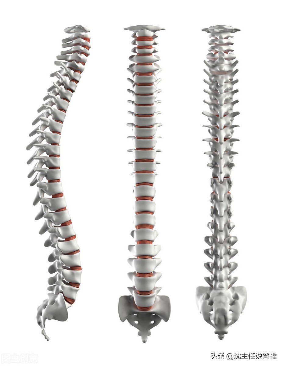 颈椎曲度变直头痛头晕一招搞定,手麻头晕头疼是什么病的前兆