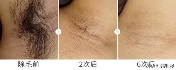 雪莉雀斑妆视频,雪莉伪素颜妆