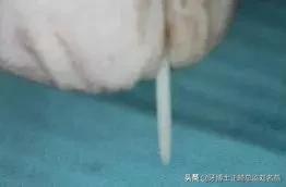 纤维桩修复费用,纤维桩修复全过程视频