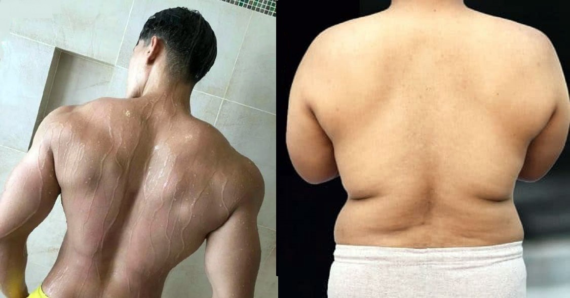 背部赘肉怎么减最快最有效的方法,怎样快速减背部的赘肉