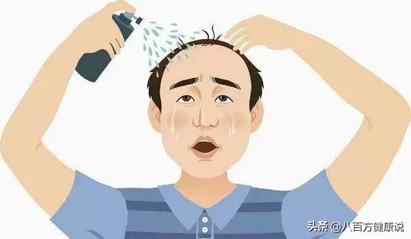 男人秃头脱发要怎么治疗,男性肾虚型脱发治疗