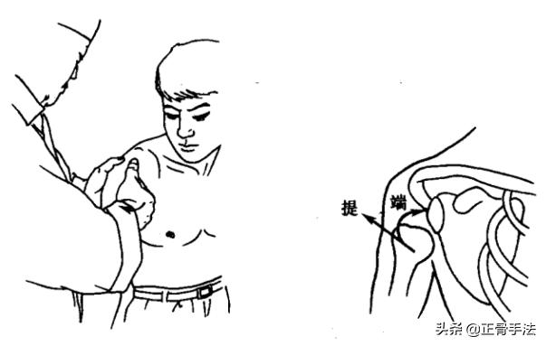 骨错则筋挪,关节脱位引起筋肉损伤时,4种整骨手法帮您复位