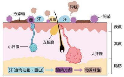 祛除腋臭,沈阳去除腋臭留下的疤痕