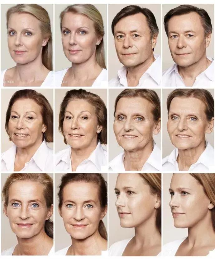 什么脸老了最容易显老,脸上有这5个特征的女人