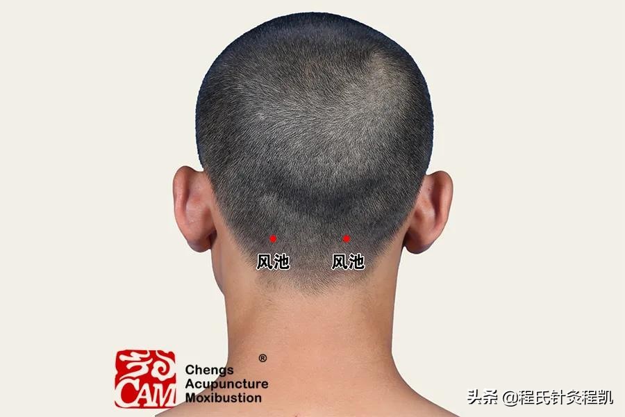 颈肩腰腿疼中药外敷特效方,外用特效治疗颈肩腰腿痛药酒配方