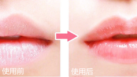 邓紫棋小红瓶,邓紫棋的金鱼嘴视频