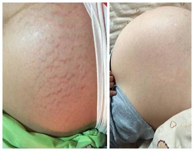 怀孕5个多月晚上睡不好,怀孕五个月半夜睡不着怎么办