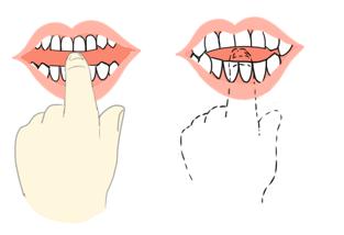 如何让小孩从小拥有一口好牙齿,牙医教小朋友如何保护牙齿