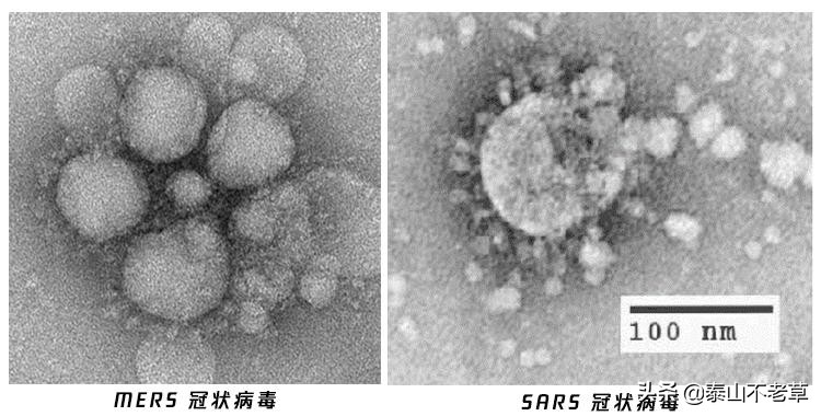 新型冠状病毒2019-ncov怎么检测,新型冠状病毒2019-ncov使用方法