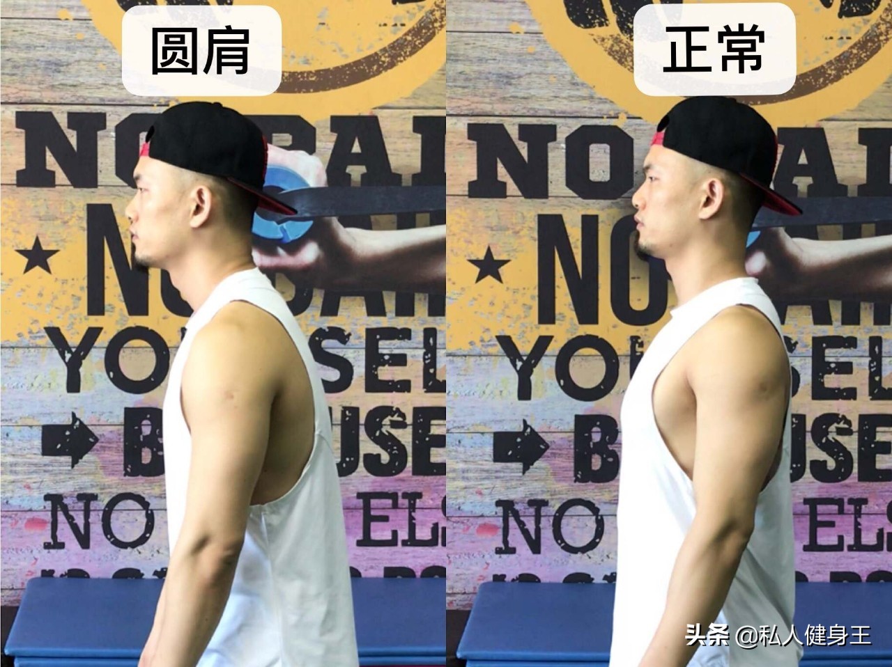 矫正圆肩的6大经典动作,圆肩驼背胸椎高怎么矫正