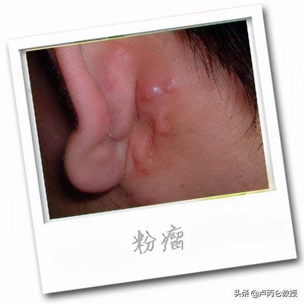 整形会有后遗症吗?为什么整形会上瘾