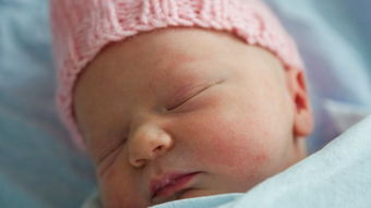 宝宝得了湿疹该怎么办,宝宝湿疹儿科医生教你快速祛湿疹