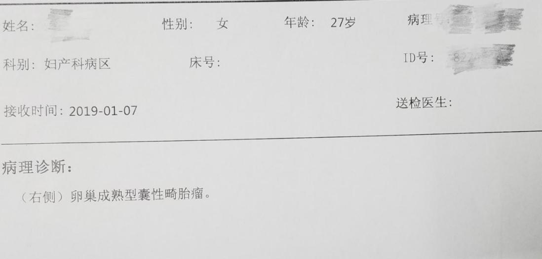 孕晚期突发腹痛:当心卵巢肿瘤扭转