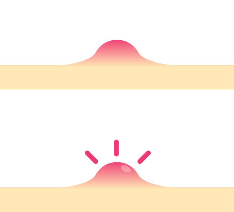 刘涛峰医生,皮肤科刘涛峰