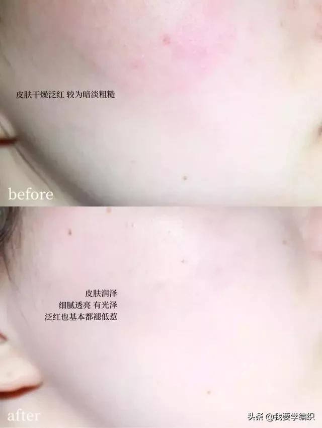 冬天脸干，连皱纹都出来了？日本女博士教你一招，抹几下白白嫩嫩