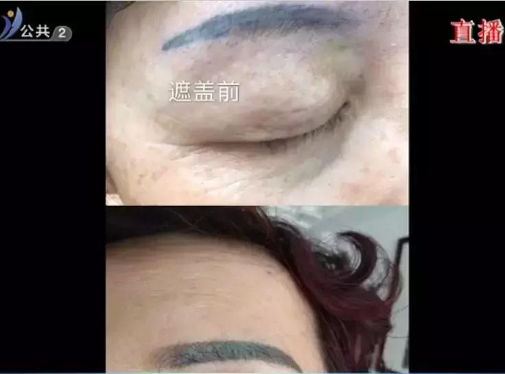 做眉毛消费太高怎么维权,398元做的眉毛维权