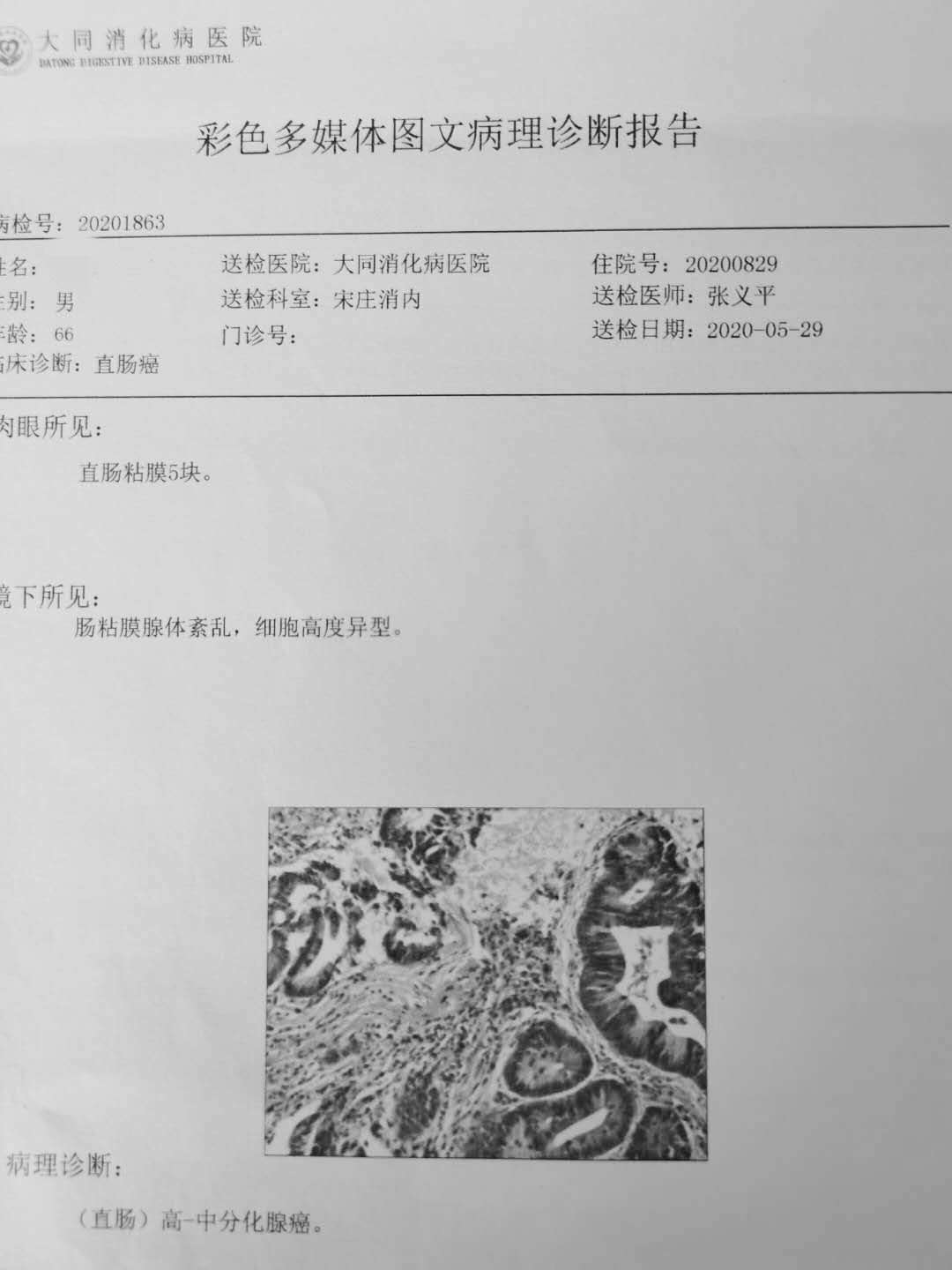 “镜”显风采,大同一专科医院应用3D腹腔镜技术成功为大肠癌患者行手术治疗
