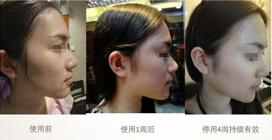 有人天生皮肤很黑然后怎么变白呢,天生皮肤黑怎么调理能变白