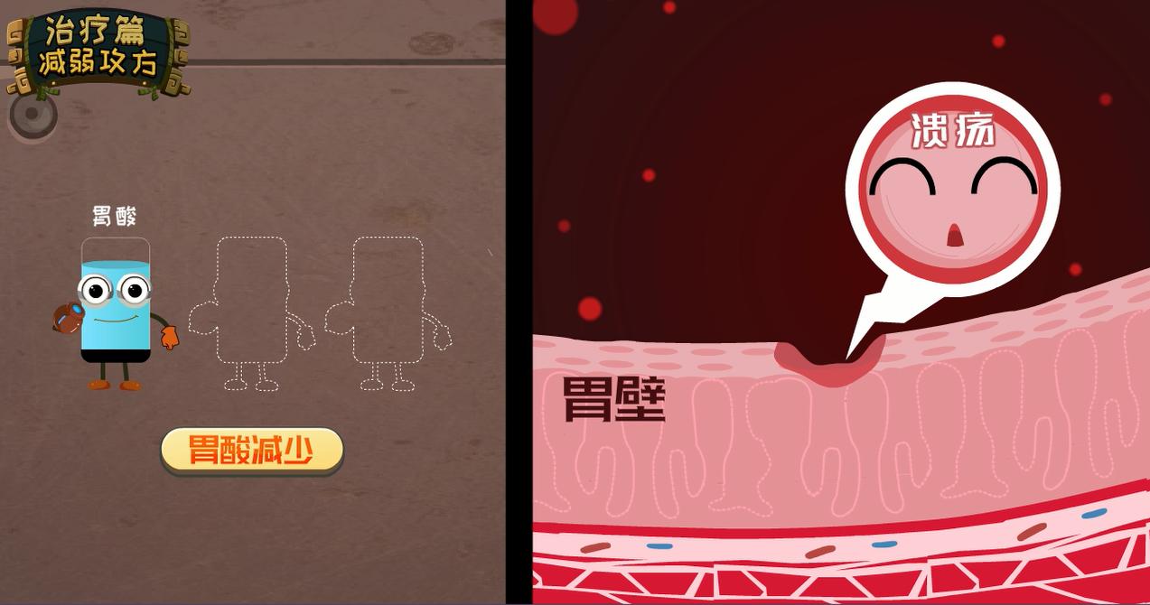 无痛胃镜真的无痛嘛,无痛超声胃镜和无痛ct