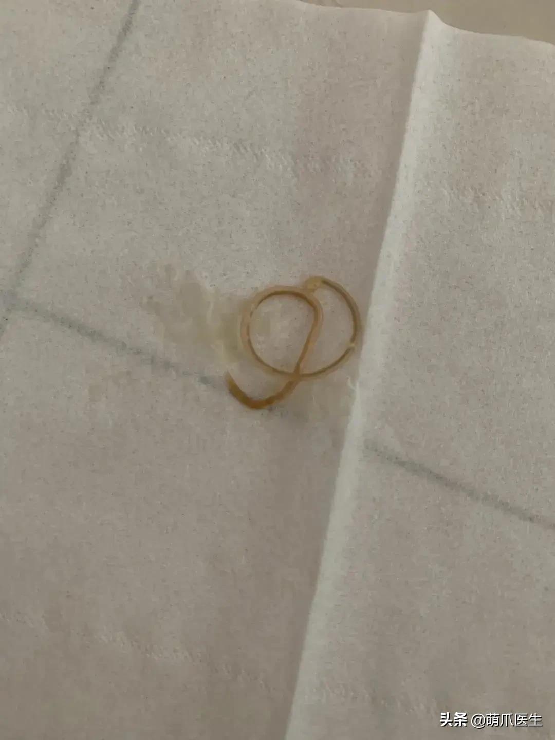 养了几年的猫有跳蚤,养了一年的猫还咬主人