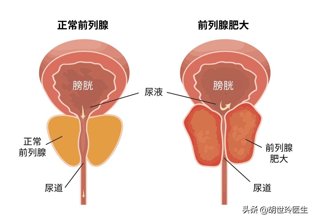 男性生殖系统养护的重要性,男性生殖保健做些什么