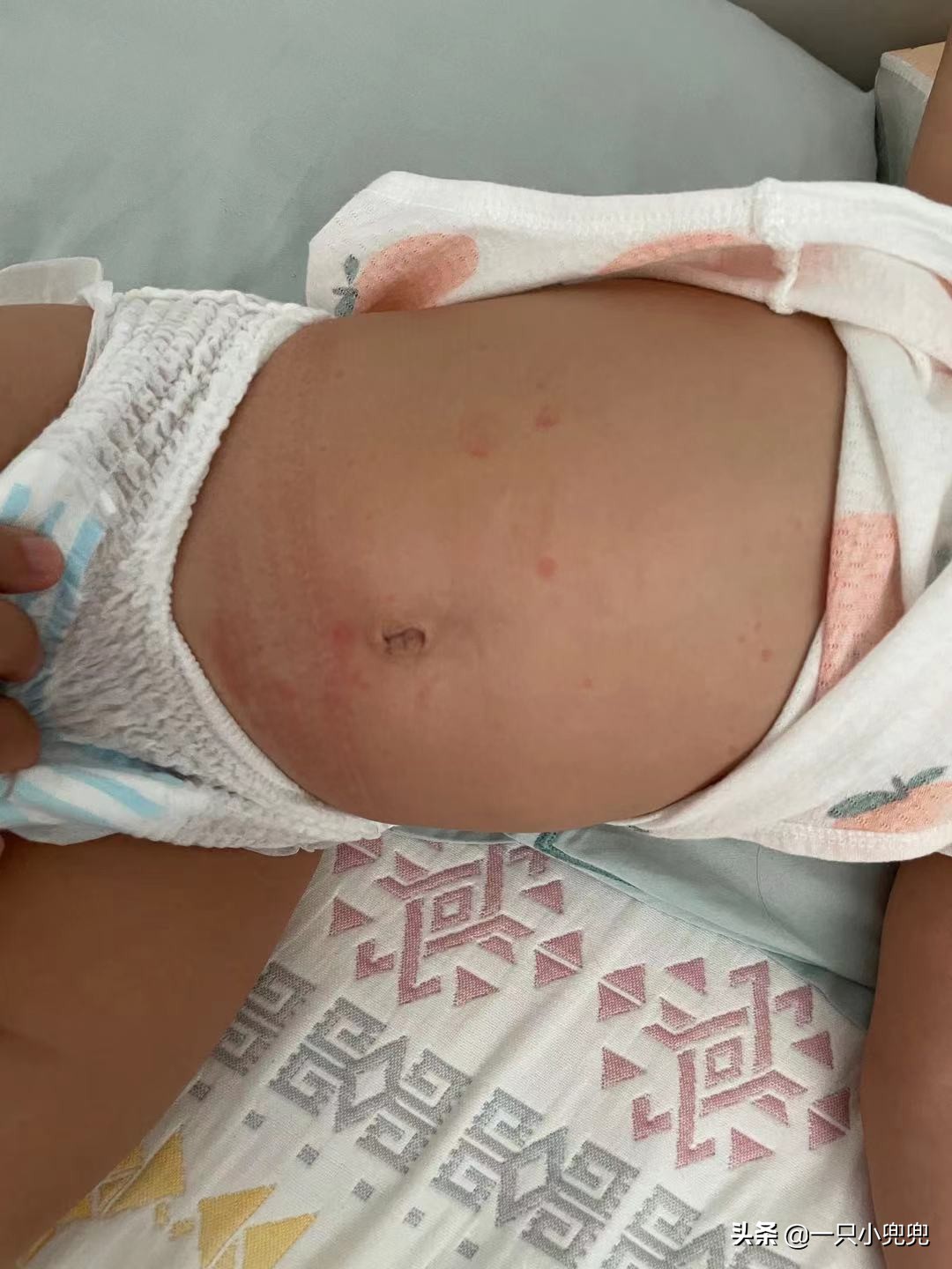 宝宝过敏怎么办六个妙招帮助你,宝宝过敏怎么办看完这篇轻松应对