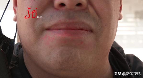 去医院治牙了还痛,牙本来不疼去医院治疗就疼了