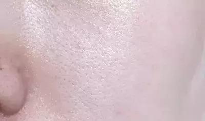 蒂佳婷的V7激光霜它的强力美白淡斑提亮到底有多强大?