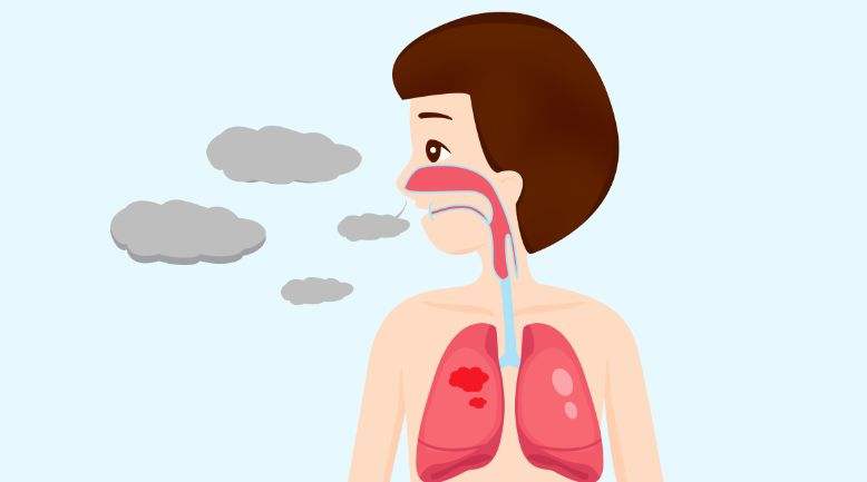 得了支气管炎咳嗽痰多怎么办,支气管炎咳嗽吐白痰能坐艾灸凳吗