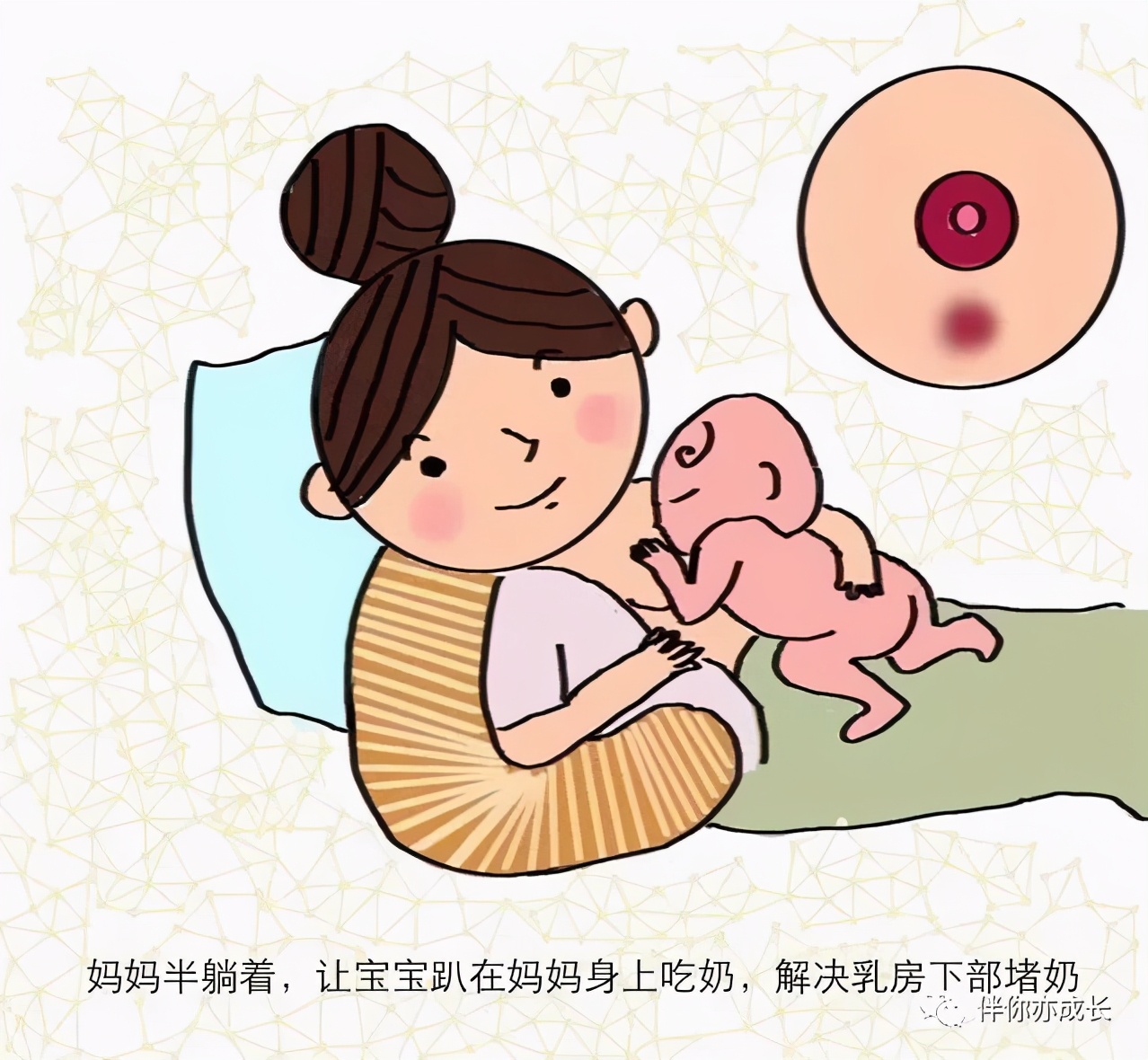 堵奶如何处理最有效,乳腺管不通奶堵怎么处理