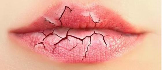 秋冬季干裂脱皮润唇膏最火,嘴唇干裂脱皮用什么润唇膏好用