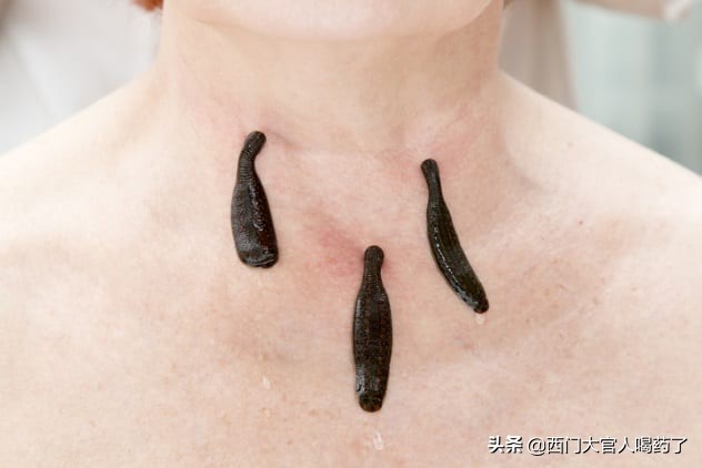 维多利亚时代为什么那么奇怪,维多利亚手术的危险