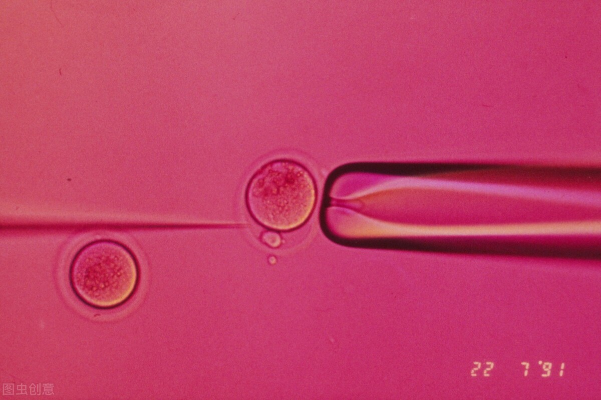 无痛试管取完卵全过程疼不疼,无痛试管取完卵过程