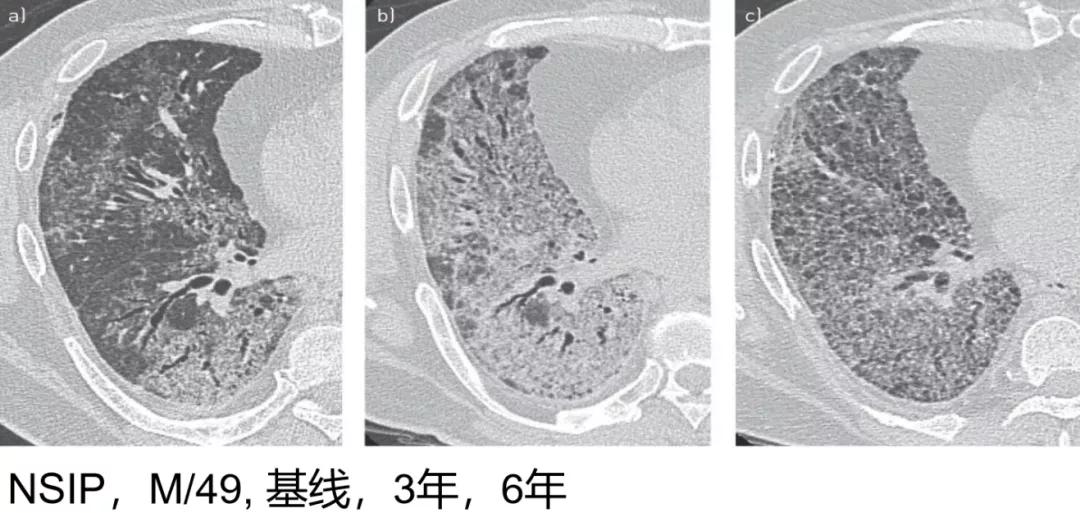 代华平视频,中日友好医院代华平