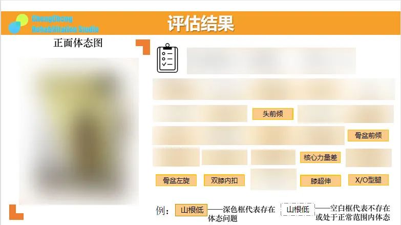 拯救腿型,o型腿睡觉姿势改善腿型