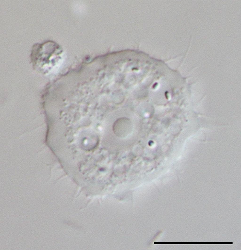 美瞳被别人戴过一次会不会怎样,戴了一次别人戴过的美瞳会怎么样