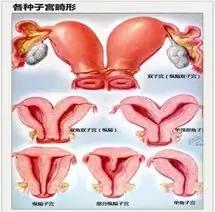要宝宝的最佳时期,一般几月份备孕生娃好