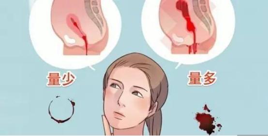 大姨妈忽多忽少是什么意思,大姨妈周期紊乱是什么原因