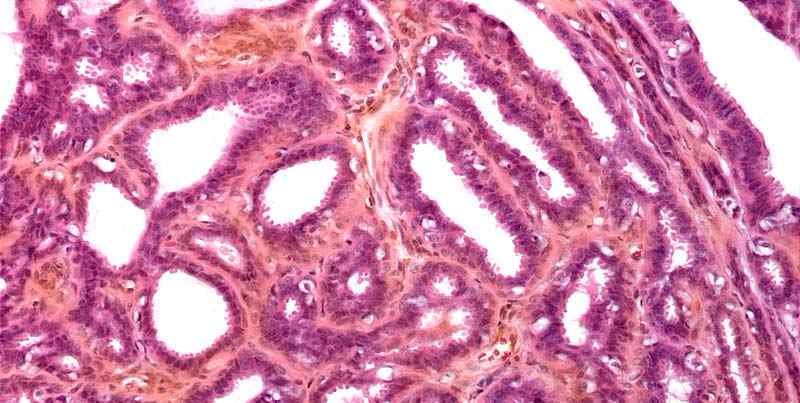 母猪乳房炎最好的治疗方案,怎样判断母猪断奶后有没有乳房炎