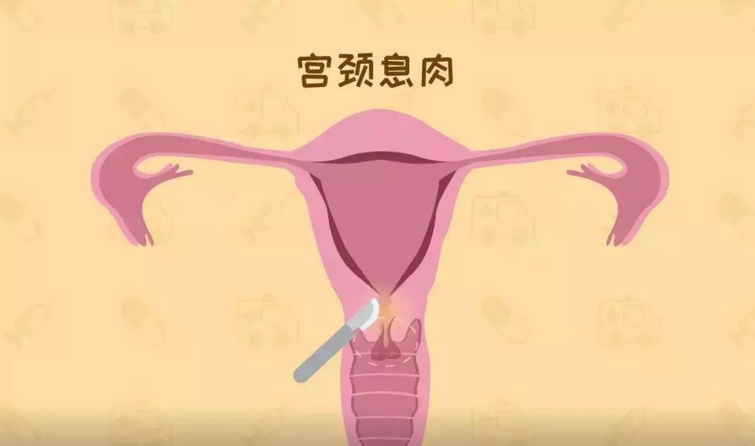 为啥啪啪啪过的女性,90%都会“喉咙”发炎?