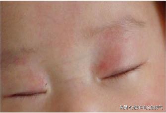 新生儿正常生理现象,新生儿正常生理现象哪四个