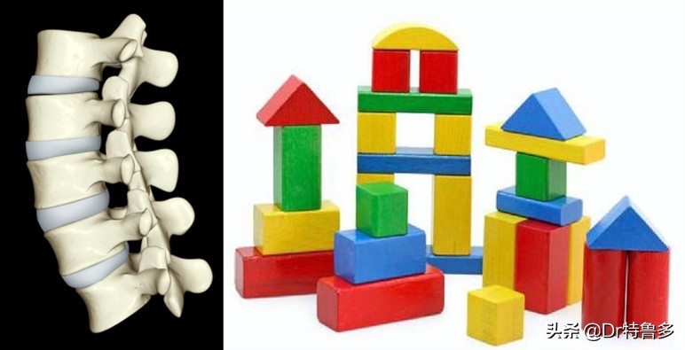 青少年腰痛，小心误诊，也有可能是得了一种“老人病”