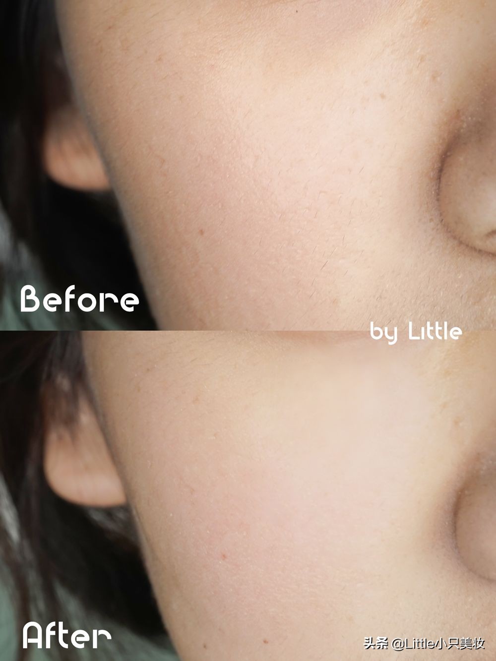 简单几招让你迅速解决粗大毛孔,改善毛孔粗大最有效的办法测评