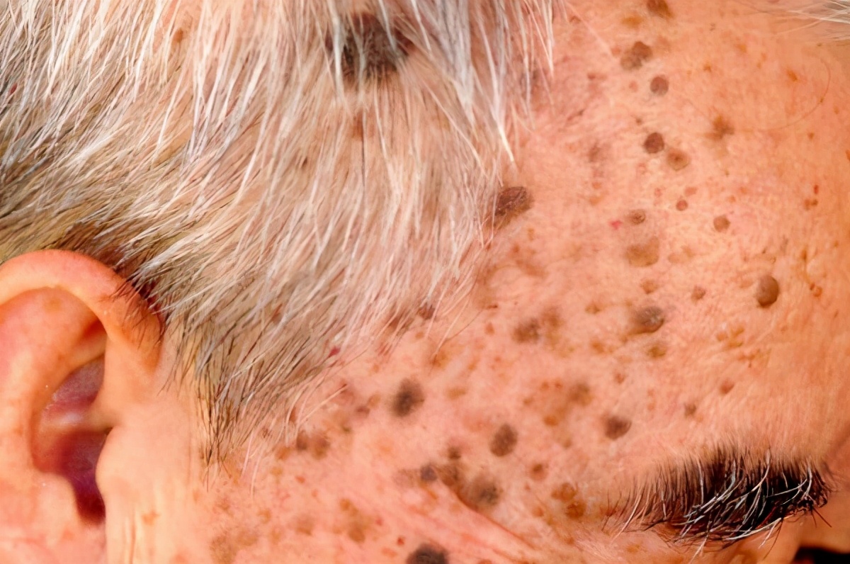 开水加白醋喝能软化血管吗,白醋软化血管的最佳方法