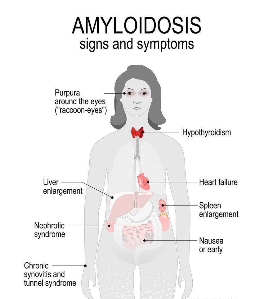 如果有甲状腺身体会出现什么反应,甲状腺患者出现4种情况