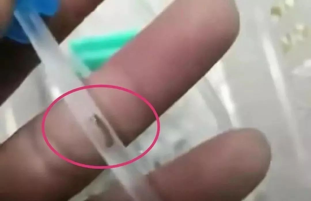 医生给小孩输液发现里面有虫,幼儿输液时输液管里疑有虫