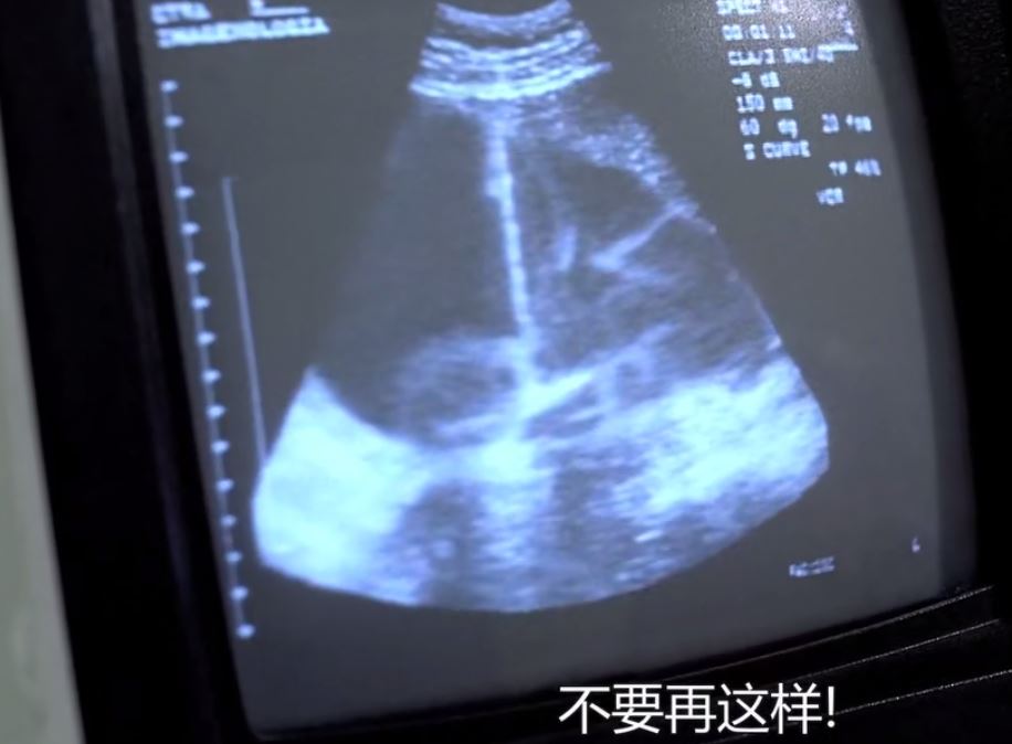 蝴蝶效应推导,蝴蝶效应揭示了什么哲学道理